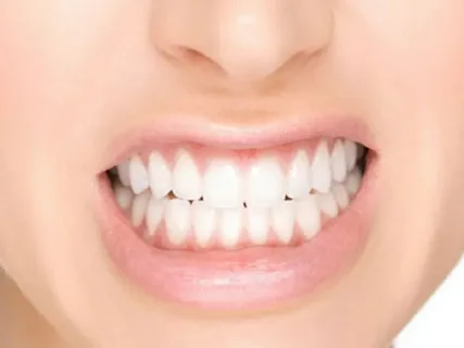 masseter botox dis sikma