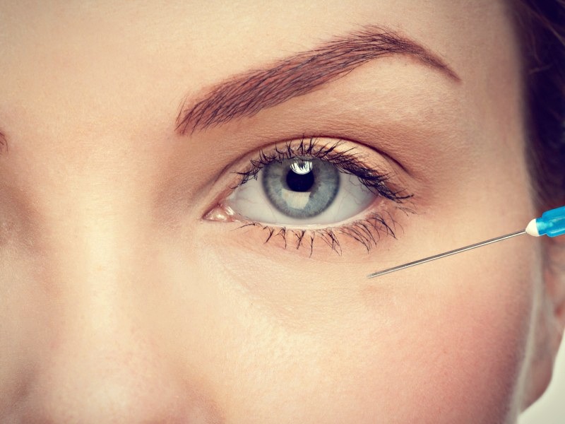 adana goz cevresi botox