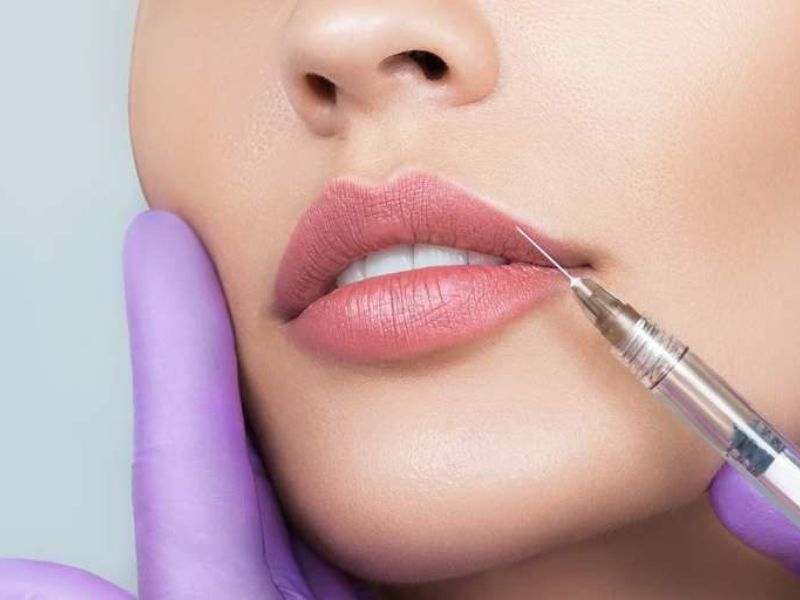 adana russian lips uygulamasinda uzman degerlendirmesinin onemi